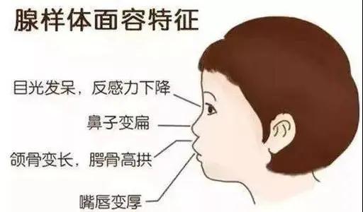 孩子睡觉打鼾、张口呼吸,小心会让孩子“变丑变笨”!